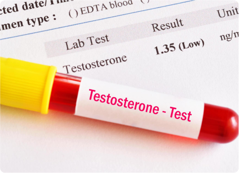 Side Effects of Finasteride