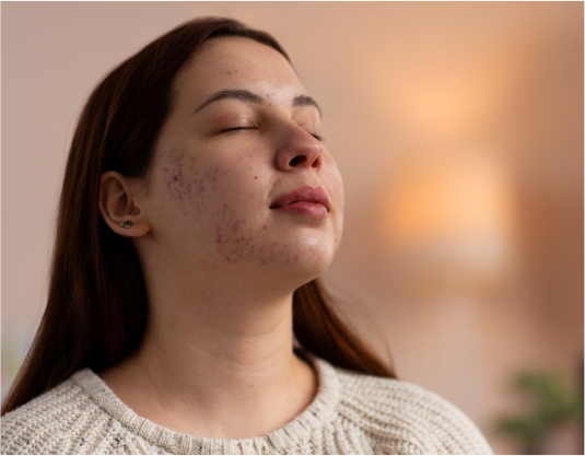 Online dermatology treatments and prescriptions